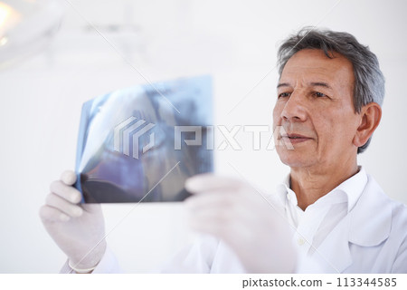 Senior dentist, man and x ray of teeth for dental surgery, healthcare and oral health with treatment at clinic. Medical professional with analysis of scan, radiology and orthodontics with mouth care 113344585