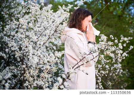 Man allergic suffering from seasonal allergy at spring in blossoming garden at springtime. Young man sneezing and blowing nose with nasal handkerchief in front of blooming tree. Spring allergy concept 113350636