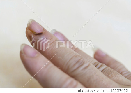 113357432