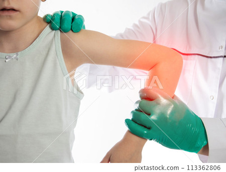 The hands of a traumatologist doctor in green medical gloves examine the girl s damaged elbow joint. Injury and dislocation of the elbow joint, bruise and fracture, redness. Growing pains 113362806