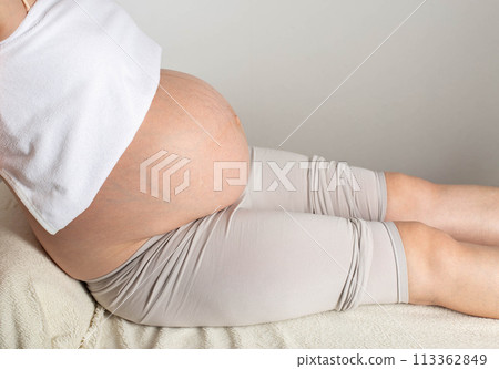 A pregnant girl sits with a bare belly in the office of a cosmetologist and massage therapist. Concept of skin care on the abdomen during pregnancy. Skin changes and stretch marks due to hormonal 113362849