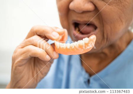 Asian elderly woman patient holding to use denture, healthy strong medical concept. 113367483