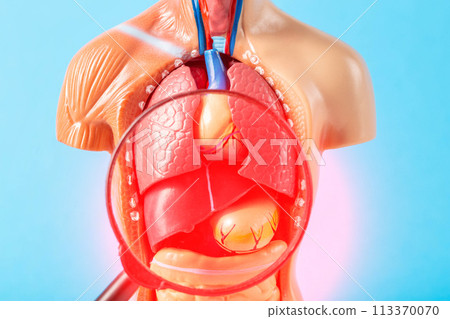 Inflamed internal organs of a human medical mockup under a magnifying glass on a blue background. Liver cirrhosis, pancreatitis and splenomegaly, close-up Inflamed internal organs of a human medical mockup under a magnifying glass on a blue background. Liver cirrhosis, pancreatitis and splenomegaly, close-up 113370070