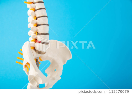 Mockup of the spine on a blue background. The concept of diseases and treatment of the spine in medicine. Back pain, sciatica, spinal fracture and injury. Copy space for text, spinal canal stenosis 113370079