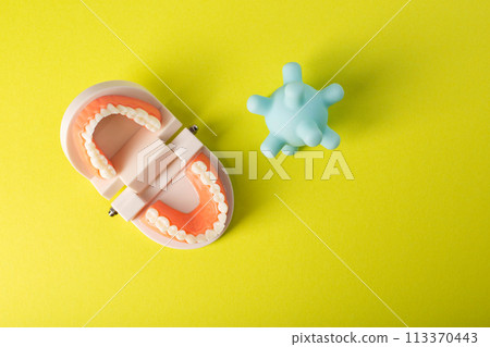 A model of a virus and bacteria near a mock-up of a dental jaw on a yellow background. The concept of oral dysbiosis, pathogenic microorganisms and microbes that destroy tooth enamel and caries. View 113370443