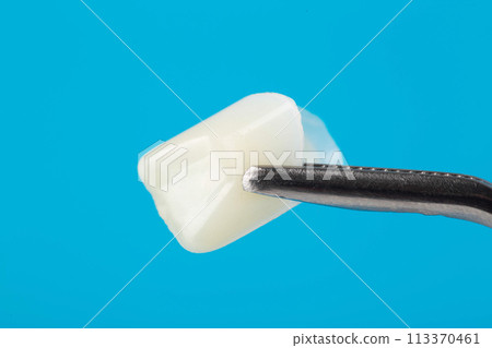 Ceramic dental crown in tweezers on a blue background, macro. The concept of dental prosthetics with crowns made of different hypoallergenic metals, aluminium oxide Ceramic dental crown in tweezers on a blue background, macro. The concept of dental prosthetics with crowns made of different hypoallergenic metals, aluminium oxide 113370461