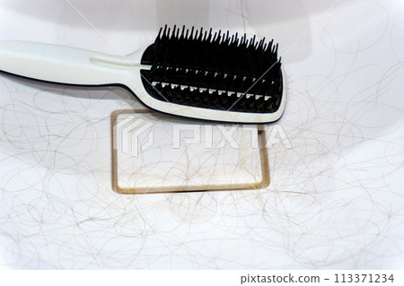 Woman holding bunch hair. Hair loss problem. Healthcare concept. Selective focus Woman holding bunch hair. Hair loss problem. Healthcare concept. Selective focus 113371234