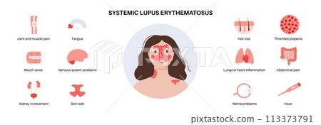 Systemic lupus erythematosus 113373791