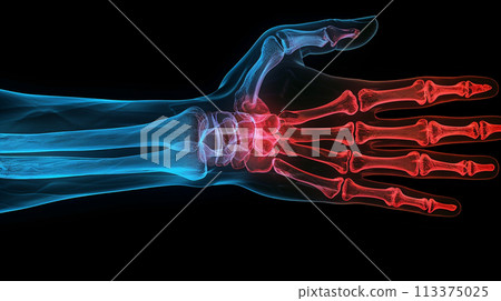Radiograph Style Illustration of a Human Hand 113375025
