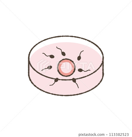 Artificial insemination, in vitro fertilization illustration. 113382523