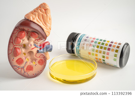 Urinalysis, Kidney model and urine cup with reagent strip pH paper test and comparison chart in laboratory. 113392396
