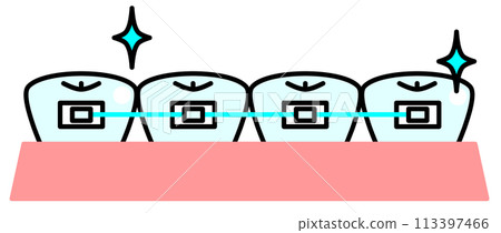 Orthodontic treatment illustration to straighten teeth beautifully Orthodontic treatment illustration to straighten teeth beautifully 113397466