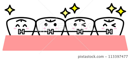 牙齒矯正插圖，美麗對齊牙齒 113397477