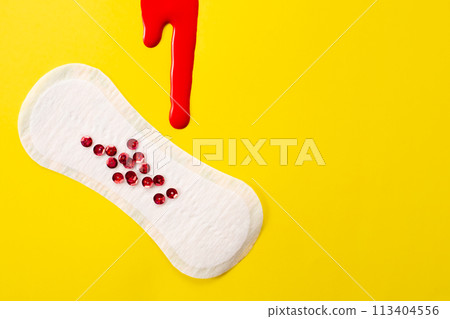 Blood and feminine hygiene pad with red glitter on yellow background. First menstrual period concept  113404556