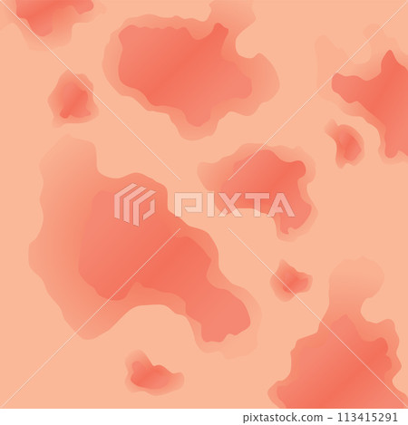Type of psoriasis vector. Part of patients skin with dermatitis, inflammation, red rash and other skin problems. Cartoon illustration for disease concept 113415291