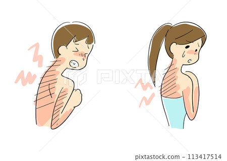 Men and women with sunburned back pain Men and women with sunburned back pain 113417514