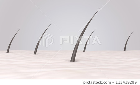 Human skin surface with dark short hair 3d rendered illustration. Skin care, hair care, hair removal concept 113419299