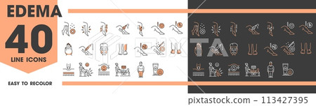 Edema line icons of leg foot and ankle disease symptoms of lymphatic varicose, vector symbols. Edema medical pictograms and line icons of body enema illness treatment, diagnostic and prevention 113427395