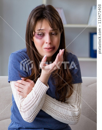 Psychologist counselling woman beaten by husband 113471408