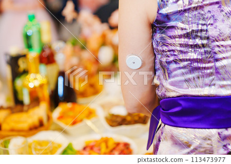 Sugar monitoring sensor on the shoulder. An insulin pump. 113473977