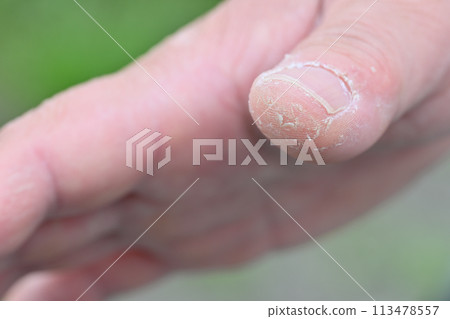 Rough hands, men, fingers, hands, rough skin Rough hands, men, fingers, hands, rough skin 113478557