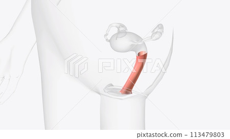 The vagina is a closed muscular canal that extends from the outside of the female genital area 113479803