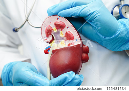 Chronic kidney disease, doctor with model for treatment urinary system, urology, Estimated glomerular filtration rate eGFR. Chronic kidney disease, doctor with model for treatment urinary system, urology, Estimated glomerular filtration rate eGFR. 113481584