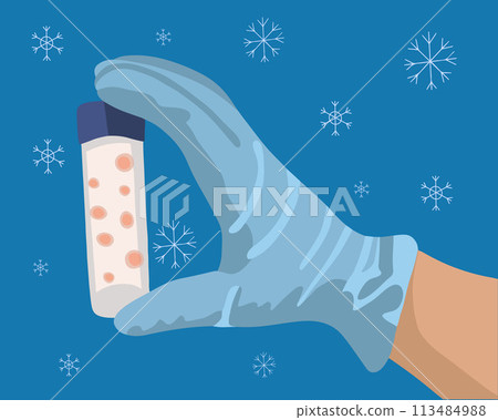 Egg freezing vector isolated illustration. Egg donation. Artificial insemination. A hand holds a test tube with egg cells. 113484988
