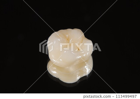 All-ceramic crown All-ceramic crown 113499497
