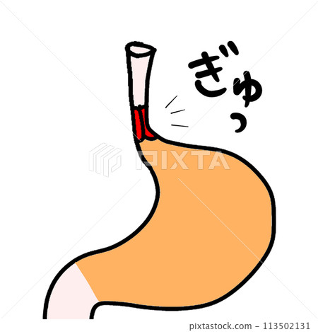 反流性食道炎的故事 反流性食道炎的故事 113502131