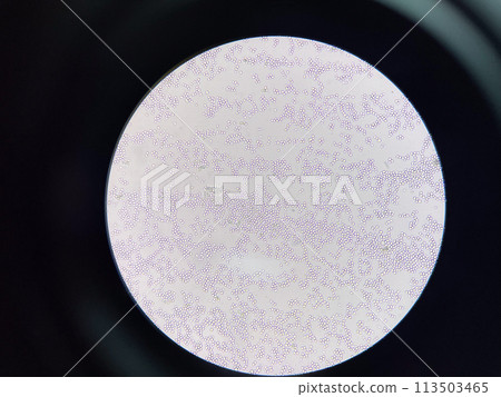 Budding yeast cell in nature. Budding yeast cell in nature. 113503465