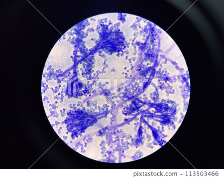 Budding yeast cell in nature. Budding yeast cell in nature. 113503466