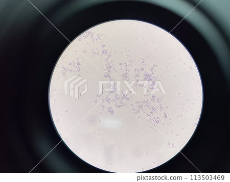 Budding yeast cell in nature. Budding yeast cell in nature. 113503469