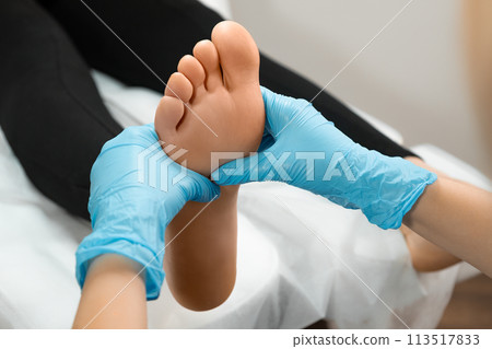 Close up of therapist or podiatrist hands massaging female foot 113517833