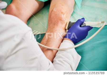 Close up of doctor making ultrasound diagnostics of boy knee. Man wearing white robe and latex gloves, examining, patient lying on couchette. Concept of healthcare and medicine. 113535789