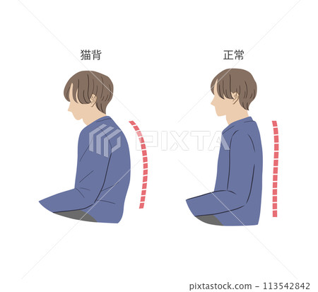 Illustration set of men with hunchback and correct posture Illustration set of men with hunchback and correct posture 113542842