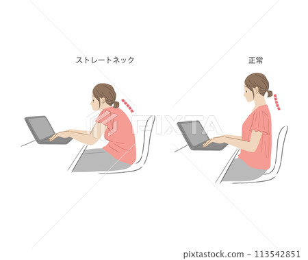 女性以駝背和正確姿勢操作電腦的插圖集 113542851