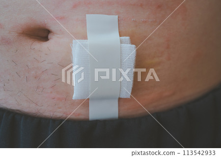 肚子 腹部 胃 113542933