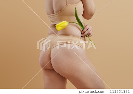 Body imperfections. Real human skin without Body imperfections. Real human skin without 113551521