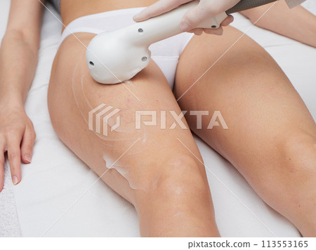 Beautician Removing Hair Of Young Woman body 113553165