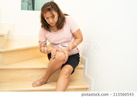 Asian lady fall down the stairs and pain at knee because slippery surfaces. 113560543