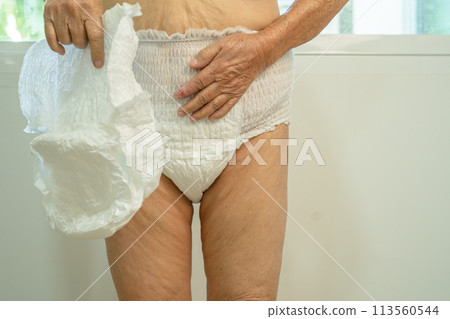 Asian senior woman patient wearing incontinence diaper in hospital, healthy strong medical. 113560544