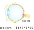 Vertical section of the eye Optic disc 113571755