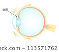 Vertical section of the eye Posterior chamber 113571762
