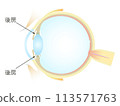 Vertical section of the eye Posterior chamber 113571763