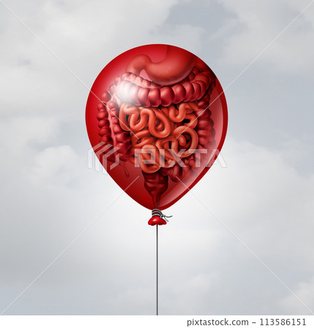 Abdominal Bloating Abdominal Bloating 113586151