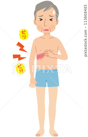 Man suffering from shingles and pain Symptoms 113608485