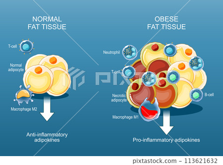 Adipose tissue and Obesity and inflammation. Close-up of a Fat cells. 113621632