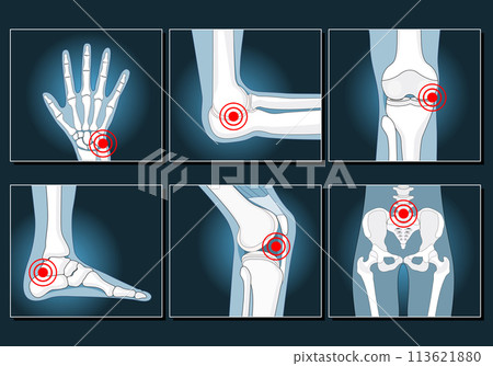 Joints Set icons like x-ray image 113621880