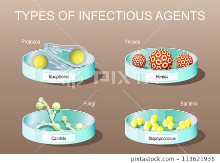 Petri dishes with Candida albicans, herpes viruses, staphylococcus, and toxoplasma 113621938